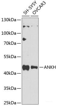 Western blot analysis of extracts of NIH/3T3 cells using Phospho-CFL1(S3) Polyclonal Antibody at dilution of 1:1000.