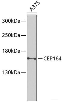 Western blot analysis of extracts from HT29 cells using Phospho-JAK2(Y1007) Polyclonal Antibody.