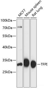 Immunohistochemistry of paraffin-embedded Rat brain using SEPT5 Polyclonal Antibody at dilution of  1:100 (40x lens).