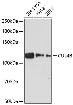 Immunohistochemistry of paraffin-embedded Rat heart using WSB2 Polyclonal Antibody at dilution of  1:100 (40x lens).