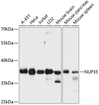 Immunohistochemistry of paraffin-embedded Human placenta using IGF2R Polyclonal Antibody at dilution of  1:100 (40x lens).