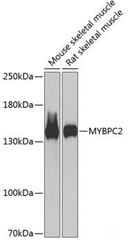 Immunofluorescence analysis of U2OS cells using CLU Polyclonal Antibody