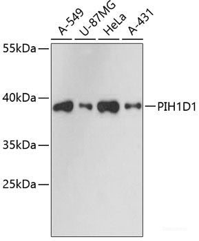 Immunohistochemistry of paraffin-embedded Rat testis using DAZL Polyclonal Antibody at dilution of  1:100 (40x lens).
