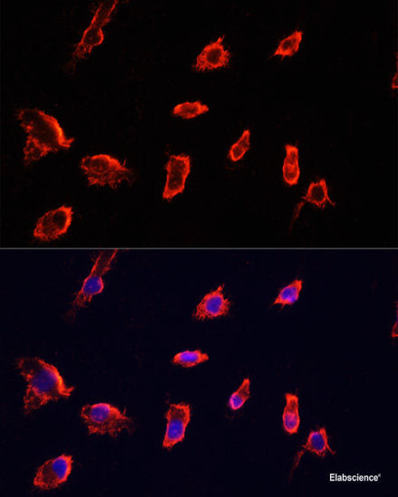 Western blot analysis of extracts of various cell lines using AKR1B10 Polyclonal Antibody at dilution of 1:1000.