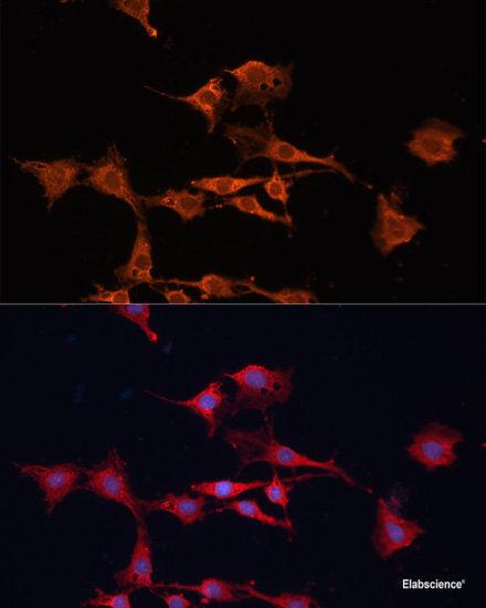 Western blot analysis of extracts of various cell lines using CALHM1 Polyclonal Antibody at dilution of 1:1000.