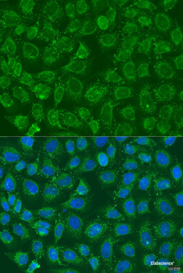 Immunohistochemistry of paraffin-embedded Rat spleen using PRKAB1 Polyclonal Antibody at dilution of  1:100 (40x lens).