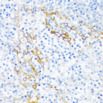 Immunohistochemistry of paraffin-embedded Human kidney using SORT1 Polyclonal Antibody at dilution of  1:100 (40x lens).