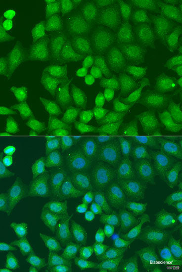 Immunohistochemistry of paraffin-embedded Rat brain using APOL1 Polyclonal Antibody at dilution of  1:100 (40x lens).