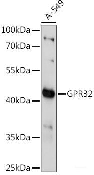 Immunohistochemistry of paraffin-embedded Rat liver using CDK6 Polyclonal Antibody at dilution of  1:100 (40x lens).