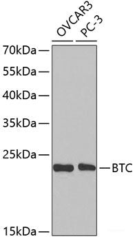 Immunohistochemistry of paraffin-embedded Human lung cancer using MMP25 Polyclonal Antibody at dilution of  1:200 (40x lens).