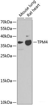 Immunohistochemistry of paraffin-embedded Rat kidney using NAA50 Polyclonal Antibody at dilution of  1:200 (40x lens).