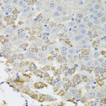 Immunohistochemistry of paraffin-embedded Human prostate using WDR77 Polyclonal Antibody at dilution of  1:200 (40x lens).