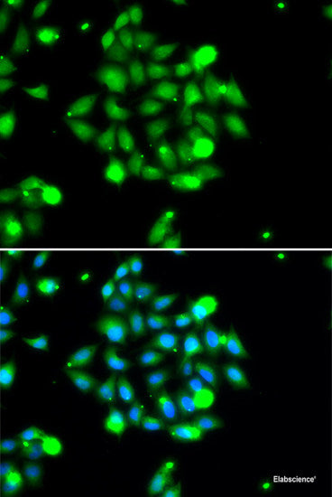 Immunohistochemistry of paraffin-embedded Rat brain using METTL20 Polyclonal Antibody at dilution of  1:100 (40x lens).