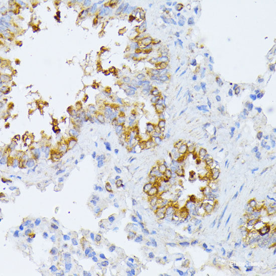 Immunohistochemistry of paraffin-embedded Rat lung using KIAA1456 Polyclonal Antibody at dilution of  1:200 (40x lens).