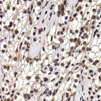 Immunofluorescence analysis of MCF-7 cells using NAT9 Polyclonal Antibody