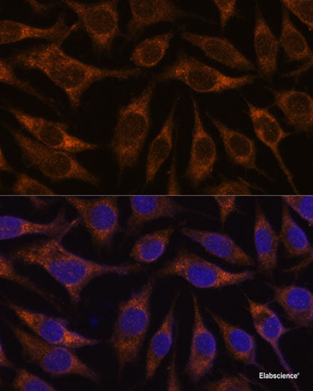 Immunofluorescence analysis of GFP-RNF168 transgenic U2OS cells using UIMC1 Polyclonal Antibody