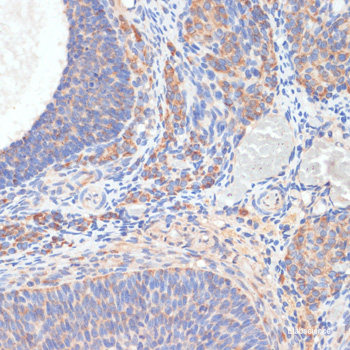 Immunofluorescence analysis of Jurkat cells using CD47 Polyclonal Antibody at dilution of  1:100. Blue: DAPI for nuclear staining.