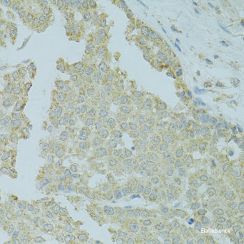 Immunofluorescence analysis of A-549 cells using PDCD5 Polyclonal Antibody