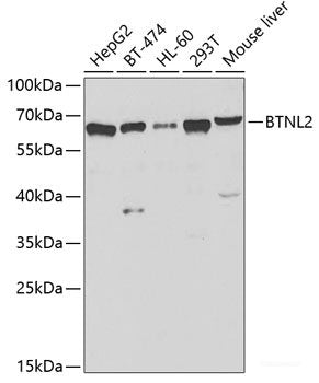 Immunofluorescence analysis of MCF-7 cells using SETD8 Polyclonal Antibody