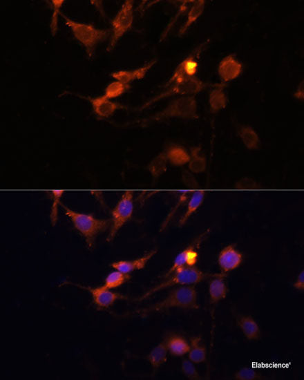 Immunofluorescence analysis of HeLa cells using Twist Polyclonal Antibody at dilution of  1:100. Blue: DAPI for nuclear staining.