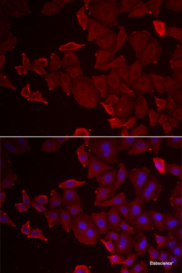 Immunohistochemistry of paraffin-embedded Rat liver using UBE2J2 Polyclonal Antibody at dilution of  1:100 (40x lens).