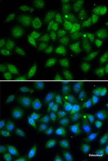 Western blot analysis of extracts of MCF-7 cells using EEF1A2 Polyclonal Antibody.