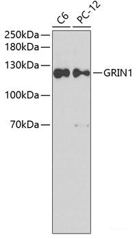 Immunohistochemistry of paraffin-embedded Rat heart using PSMB8 Polyclonal Antibody at dilution of  1:100 (40x lens).