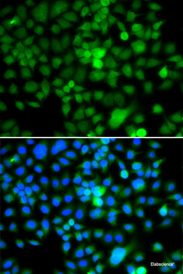 Immunohistochemistry of paraffin-embedded Human colon carcinoma using ZAK Polyclonal Antibody at dilution of  1:100 (40x lens).