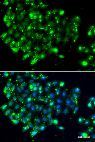 Immunohistochemistry of paraffin-embedded Mouse cancer using UBE2R2 Polyclonal Antibody at dilution of  1:100 (40x lens).