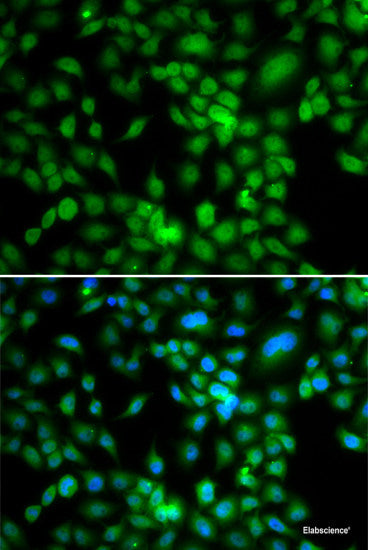 Immunofluorescence analysis of A549 cells using NAA40 Polyclonal Antibody