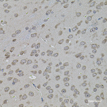 Immunohistochemistry of paraffin-embedded Rat heart using JMJD7 Polyclonal Antibody at dilution of  1:100 (40x lens).
