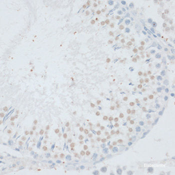 Immunofluorescence analysis of C6 cells using Acetyl-Histone H4-K91 Polyclonal Antibody at dilution of  1:100.C6 cells were treated by TSA (1 uM) at 37℃ for 18 hours. Blue: DAPI for nuclear staining.