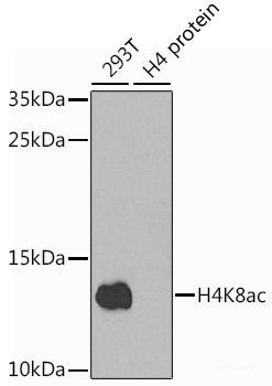 Immunohistochemistry of paraffin-embedded Human gastric using HSPE1 Polyclonal Antibody at dilution of  1:100 (40x lens).