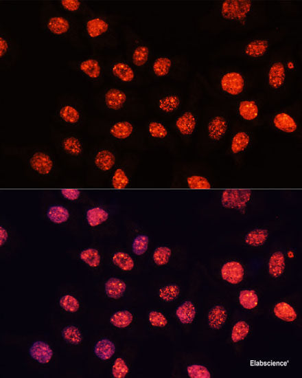Western blot analysis of extracts of various cell lines using NME2 Polyclonal Antibody at dilution of 1:1000.