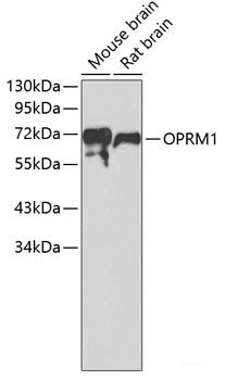 Western blot analysis of extracts of various cell lines using FURIN Polyclonal Antibody at dilution of 1:1000.