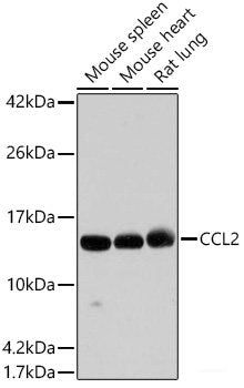 Western blot analysis of extracts of various cell lines using FGFBP1 Polyclonal Antibody at dilution of 1:1000.