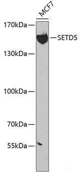 Immunohistochemistry of paraffin-embedded Rat brain using Fibronectin Polyclonal Antibody at dilution of  1:100 (40x lens).
