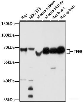 Western blot analysis of extracts of various cell lines using PPP3R2 Polyclonal Antibody at dilution of 1:1000.