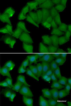 Immunohistochemistry of paraffin-embedded Human kidney using RAB1B Polyclonal Antibody at dilution of  1:100 (40x lens).