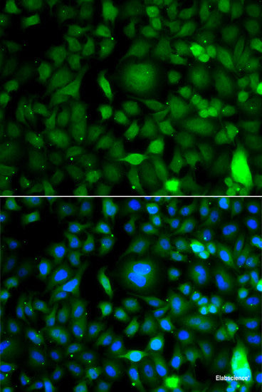 Immunofluorescence analysis of A549 cells using HIF2A Polyclonal Antibody