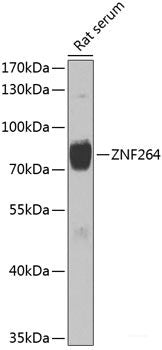 Western blot analysis of extracts of MCF-7 cells using KRT6A Polyclonal Antibody at dilution of 1:1000.