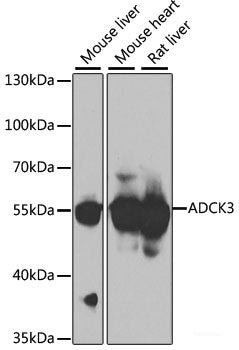 Immunohistochemistry of paraffin-embedded Rat brain using C1GALT1C1 Polyclonal Antibody at dilution of  1:100 (40x lens).