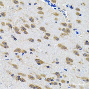 Western blot analysis of extracts of Rat brain using TTBK2 Polyclonal Antibody at dilution of 1:1000.