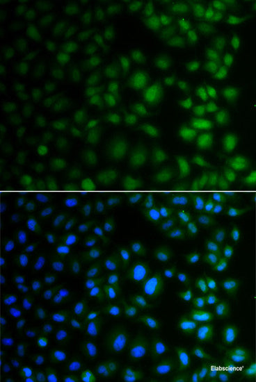 Western blot analysis of extracts of Mouse testis using KIF6 Polyclonal Antibody at dilution of 1:1000.
