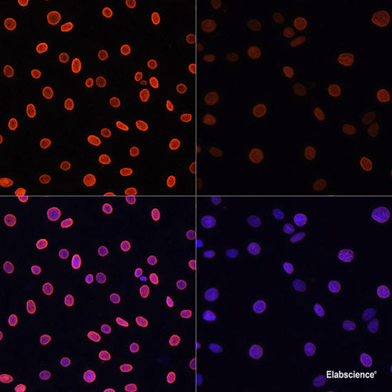 Western blot analysis of extracts of various cell lines using UBIAD1 Polyclonal Antibody at dilution of 1:1000.