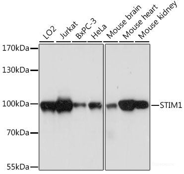Western blot analysis of extracts of various cell lines using ANXA8L2 Polyclonal Antibody at dilution of 1:1000.