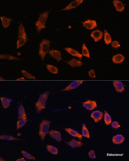 Western blot analysis of extracts of various cell lines using DDX11 Polyclonal Antibody at dilution of 1:1000.