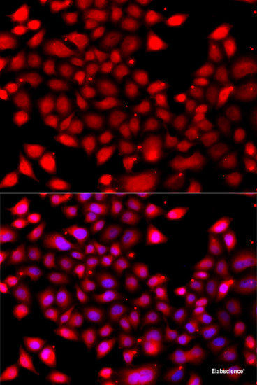 Immunohistochemistry of paraffin-embedded Rat ileum using ARID3A Polyclonal Antibody at dilution of  1:100 (40x lens).