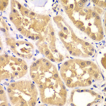 Immunofluorescence analysis of U2OS cells using HSD17B3 Polyclonal Antibody at dilution of  1:100. Blue: DAPI for nuclear staining.