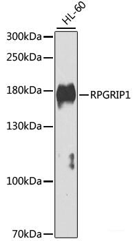 Immunofluorescence analysis of U2OS cells using KRT6B Polyclonal Antibody at dilution of  1:100. Blue: DAPI for nuclear staining.